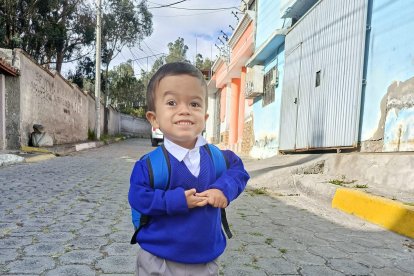 En el país existen alrededor de 6 mil casos de niños con acondroplasia