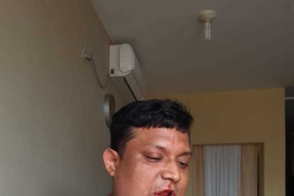 Vicente Barahona mostró como quedó su rostro luego de la supuesta agresión del jugador.