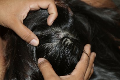 Una niña, de 5 años, sufrió un golpe en el cráneo. No fue grave, pero necesitaba reposo.