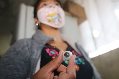 El adolescente debe usar una prótesis diferente cada año.