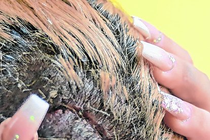 Los médicos le dieron 10 puntadas en la cabeza, la herida más grande que dejó el ataque.