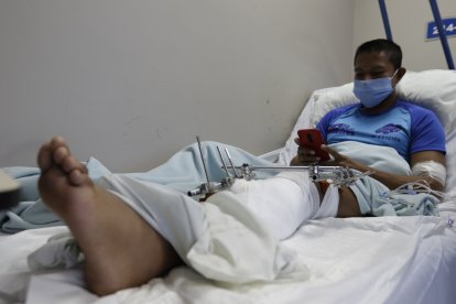 Otro de los policías sufrió una fractura en su pierna izquierda durante la reyerta de la 'Peni'