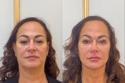 Nadine Gonçalves está atravesando por un proceso estético.