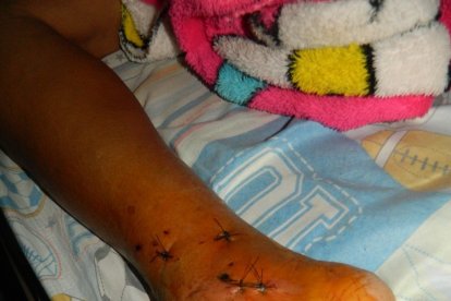 La mujer fue llevada al hospital básico, donde le inyectaron y le curaron las mordeduras