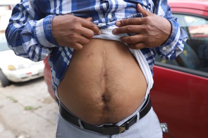 En su cuerpo tiene 45 puntos de sutura. A estos él los denomina las cicatrices de la desobediencia.