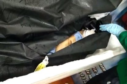 Así abren las bolsas de bioseguridad para tomar las fotos o grabar un video.