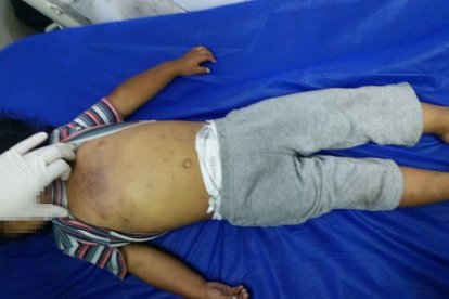 La víctima tenía varias heridas en el pecho y el rostro.