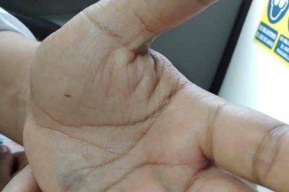 La mujer tenía heridas de defensa en las manos.