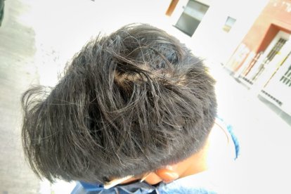 El afectado tuvo una rotura en su cabeza que fue suturada en un centro médico.