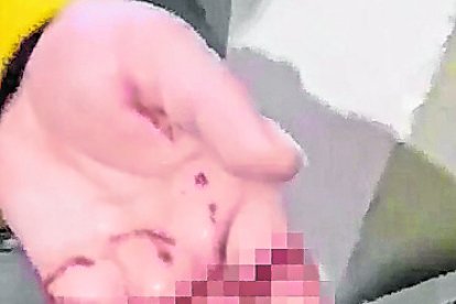 Los cortes dañaron los tendones de la mano izquierda de la víctima.