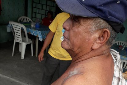Wilson Castro, por no abrir la puerta de su casa recibió dos disparos.