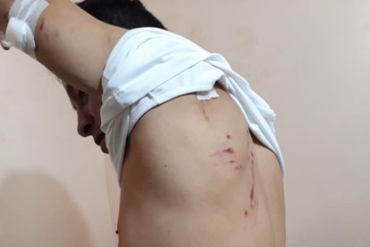 Por el primer ataque, David Robles estuvo un mes en cama.