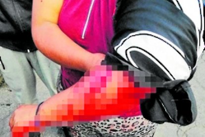 El agresor de la mujer no fue detenido. Ella fue atendida en un hospital.