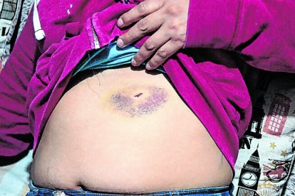 La mujer tiene 9 semanas de gestación y corre el riesgo de perder a la criatura.