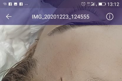 Le pegaron las heridas con brujita.