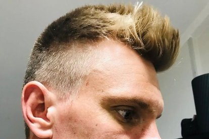 Así quedó el rostro del arquero