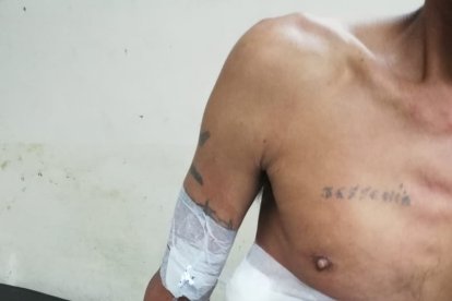 En la casa de salud suturaron la herida del ciudadano.