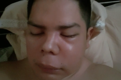 Christian Albán está con terapia del dolor y dice que no se quiere ver a la espejo