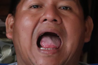 Ítalo Cruz muestra como quedó su órgano.