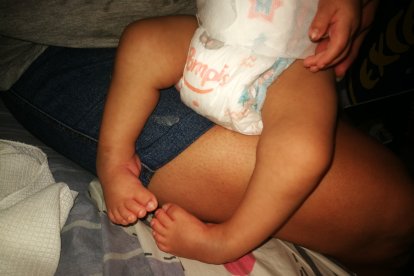 El niño tiene malformación en los pies y requiere de terapias físicas y medicinas.