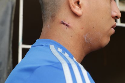 El adolescente sufrió una herida en el cuello.