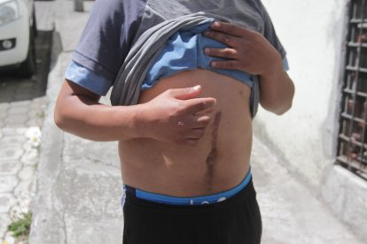 David Lema muestra cómo le dejaron unos sujetos que le intentaron robar.