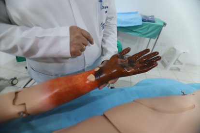 Muestran los tipos de quemaduras.