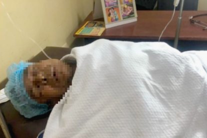 Los heridos se recuperan en casas de salud con custodia policial.