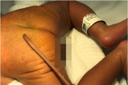 La cola del recién nacido medía 12 centímetros.