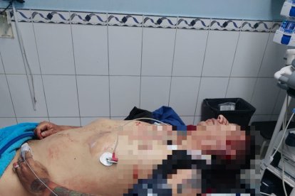 Parchado era un presunto ‘brujo’  del sector, según moradores de Solanda.