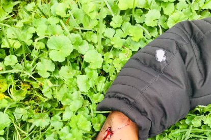 Uno de los  disparos que recibió la víctima le atravesó la mano.