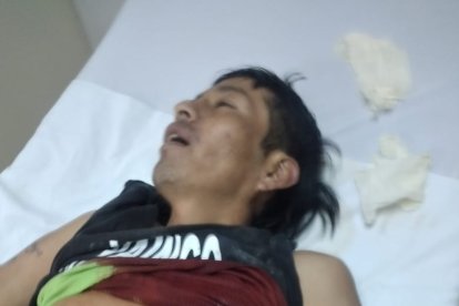 La víctima murió desangrada; tenía una herida en la parte izquierda del tórax.