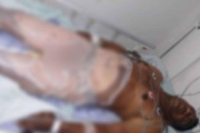 Así quedó la víctima.