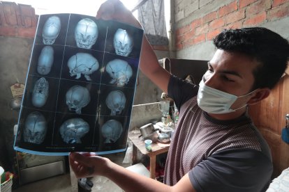 En la radiografía se puede ver cómo el cráneo está creciendo ovaladamente.