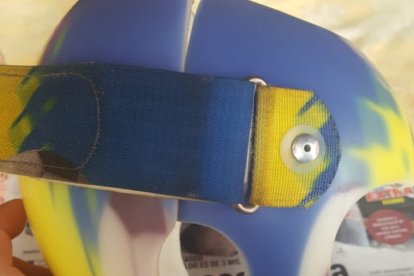 Desde la capital les llegó el casco ortopédico que cuesta 3.000 dólares.