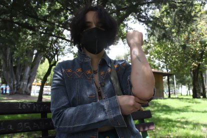 Andrys Castillo tiene moretones en los brazos por los toletazos que le habrían propinado los policías.