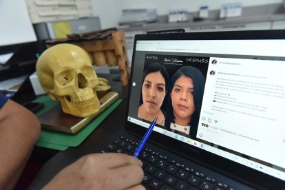 Según los cirujanos plásticos, las mujeres son quienes se realizan más intervenciones.