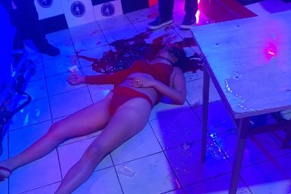 La trabajadora sexual recibió un balazo en la cabeza. Ella perdió la vida en el hospital.