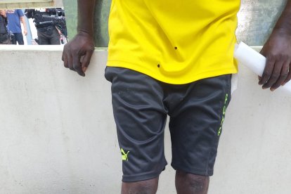 A esta persona la habían encadenado y atado los pies. Presentaba signos de tortura.