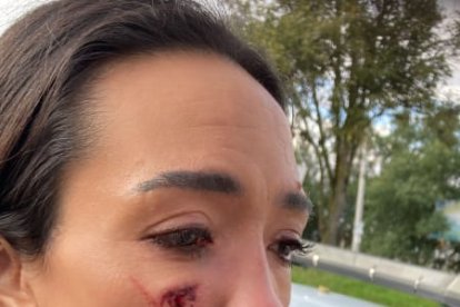 La agresión causó que se le abriera el pómulo derecho.