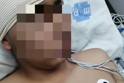 La bala que le impactó en el cráneo afectó un músculo facial.