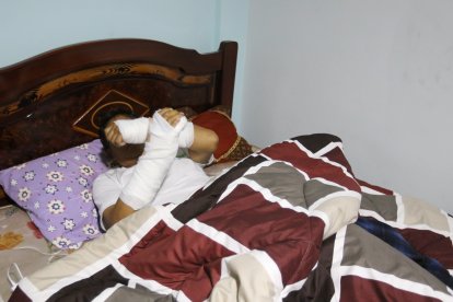 Luis muestra   sus brazos que fueron enyesados tras el ataque.