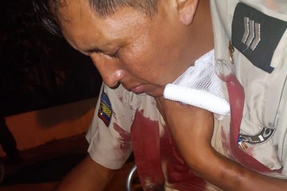 Uno de los agentes fue baleado con perdigones en el pecho.