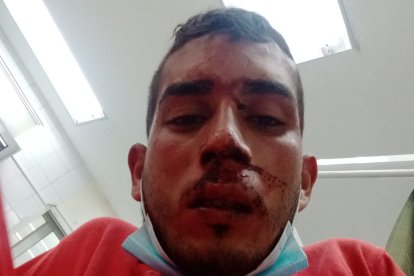 El comerciante luego del enfrentamiento.