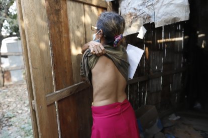 Benis no sabe por qué le da un fuerte dolor por todo el cuerpo, en especial en la espalda.