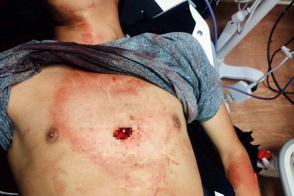 El menor de edad  murió desangrado mientras era llevado al hospital.