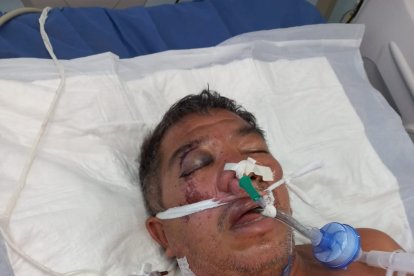 El afectado tiene fracturas en su rostro y un sangrado en su cerebro.