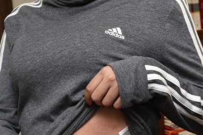 La joven presentaba hematomas en su abdomen, donde aseguró que el desconocido le propinó varios puntapiés