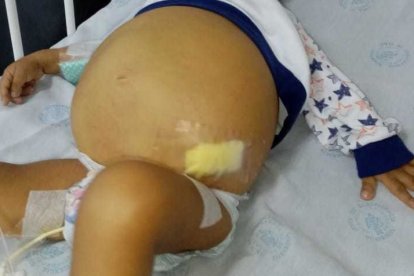 La barriga del pequeño se hincha y hace que le cueste respirar.