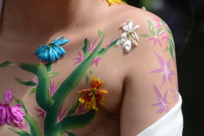 La amputación ha sido la forma más eficiente para frenar el avance de la enfermedad, no siempre funciona.  Quito 03 de Octubre de 2022 Agencia(ag-extra ag-expreso-ag-quito) Gustavo Guaman